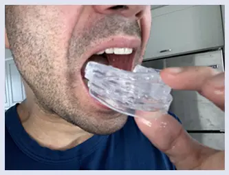 how to use dream hero mouth guard step 2